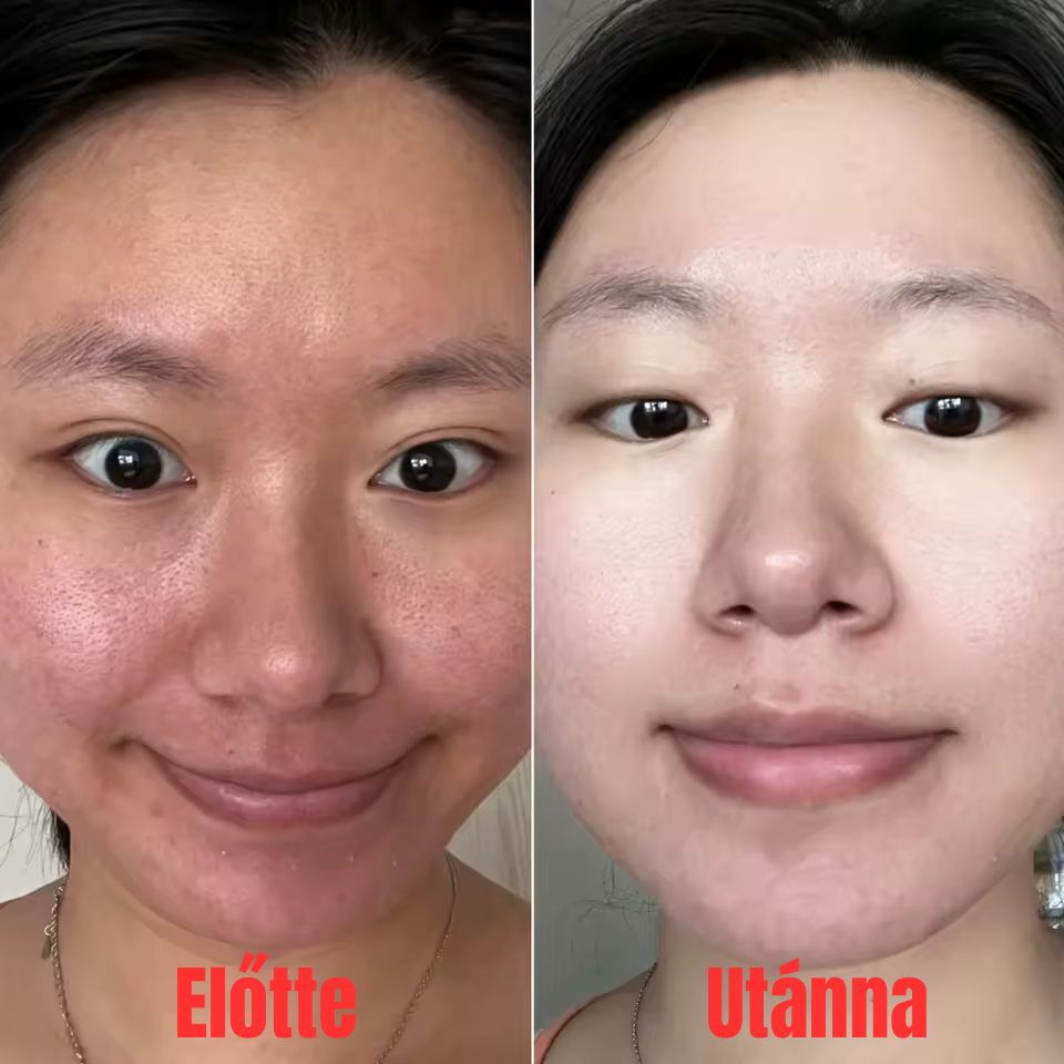 Pórusfinomító fényesítő arcszérum retinollal