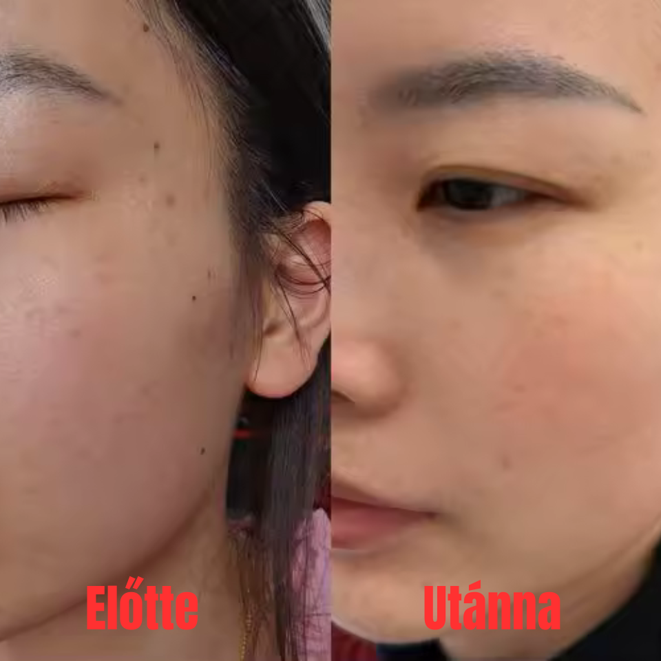 Pórusfinomító fényesítő arcszérum retinollal